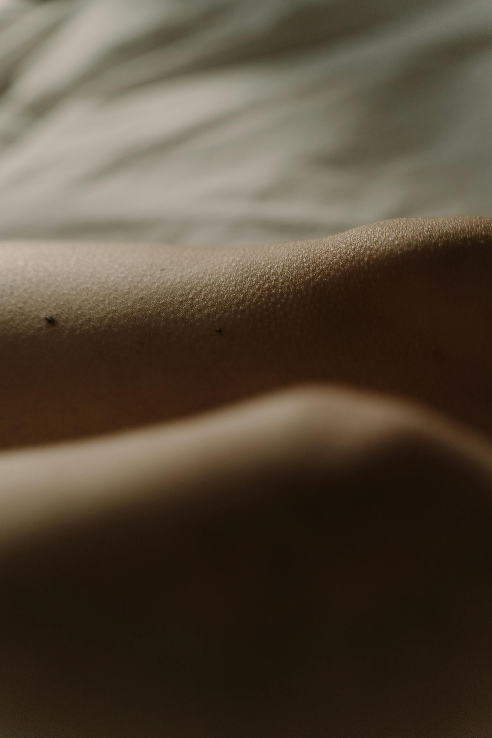 Detailed close-up of human skin showing natural texture and small moles.